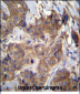 ATP6V1B1 Antibody (C-term)