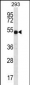 ATP6V1B1 Antibody (C-term)