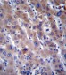 FADS2 Antibody (N-term)