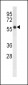 FADS2 Antibody (N-term)