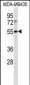 LILRB4 Antibody (N-term)