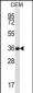 FSTL3 Antibody (C-term)