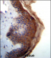 IL1F5 Antibody (N-term)
