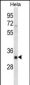 SFRS7 Antibody (N-term)