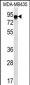 FYB Antibody (C-term)