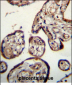 CALU Antibody (C-term)