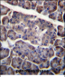 PDCD1LG2 Antibody (N-term)
