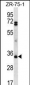 PDCD1LG2 Antibody (N-term)