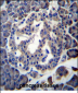 MBOAT4 Antibody (Center)