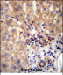 DVL1 Antibody (Center)