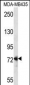 DVL1 Antibody (Center)