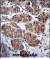 PCDHGC5 Antibody (Center)