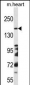 DCC Antibody (Center)