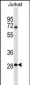 RPL11 Antibody (N-term)