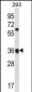 OR52E2 Antibody (C-term)