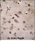 TSN Antibody (Center)