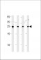 TSN Antibody (Center)