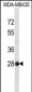 SNRPB2 Antibody (N-term)