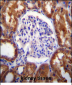 SLC12A6 Antibody (N-term)
