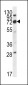 IGSF8 Antibody (Center)