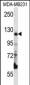 PITRM1 Antibody (Center)