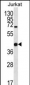 LGALS4 Antibody (N-term)