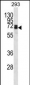 DLL3 Antibody (C-term)