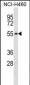 SLC16A3 Antibody (C-term)