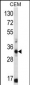 FFAR1 Antibody (C-term)