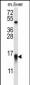 MYCBP Antibody (N-term)