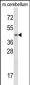 TCF7L2 Antibody (N-term)