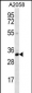 CNN2 Antibody (N-term)