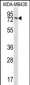 UNC84B Antibody (Center)