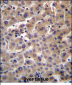 GUSB Antibody (C-term)