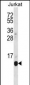 POLR2G Antibody (C-term)