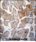 RPS6KC1 Antibody (N-term)