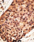 MMP16 Antibody (N-term)