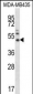 MMP16 Antibody (N-term)