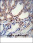 MMP2 Antibody