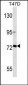 MMP2 Antibody