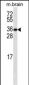 GBL Antibody (ascites)