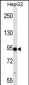 MAP3K11 Antibody (ascites)