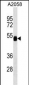 FUCA2 Antibody