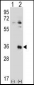 TSSK6 Antibody (N-term)