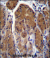 TSSK6 Antibody (C-term)