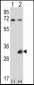 TSSK6 Antibody (C-term)