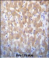 FASTK Antibody (C-term)