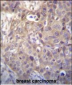 HIPK1 Antibody (C-term)