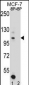 HIPK1 Antibody (C-term)