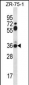 STX2 Antibody (Center)